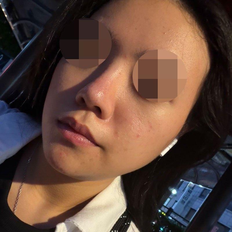 后