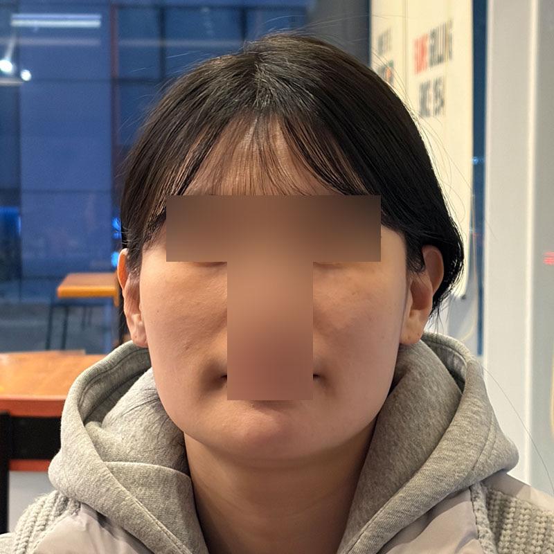 前