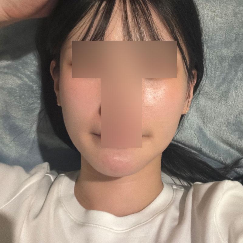 后