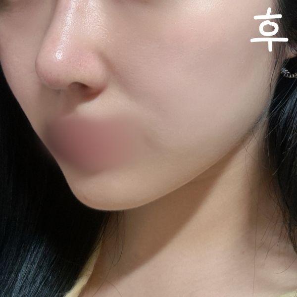 後