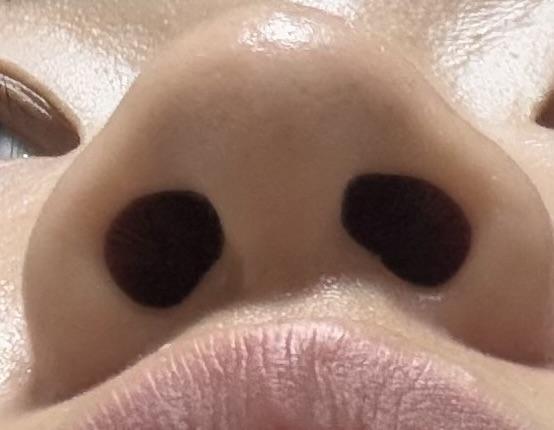 後