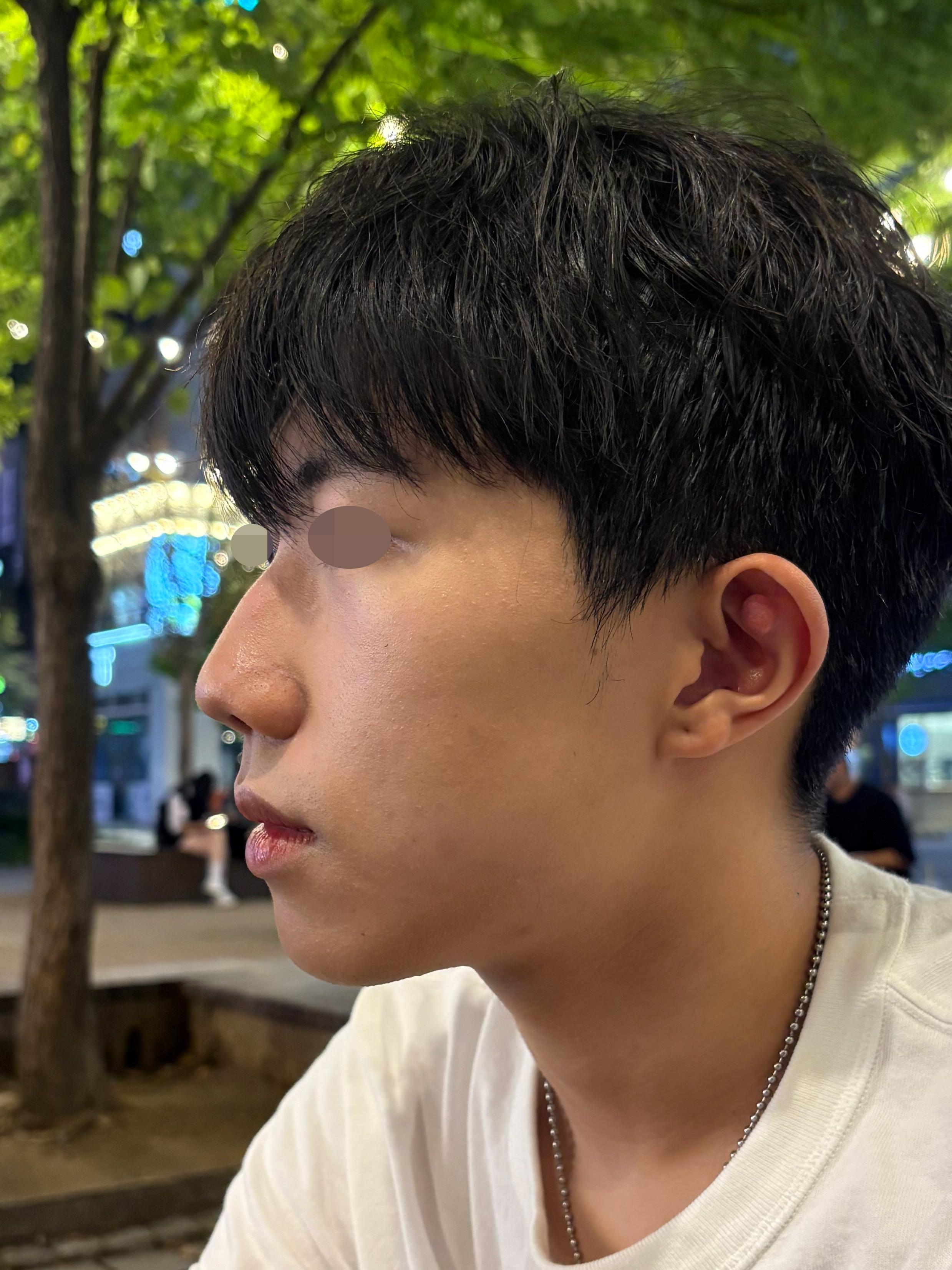 後