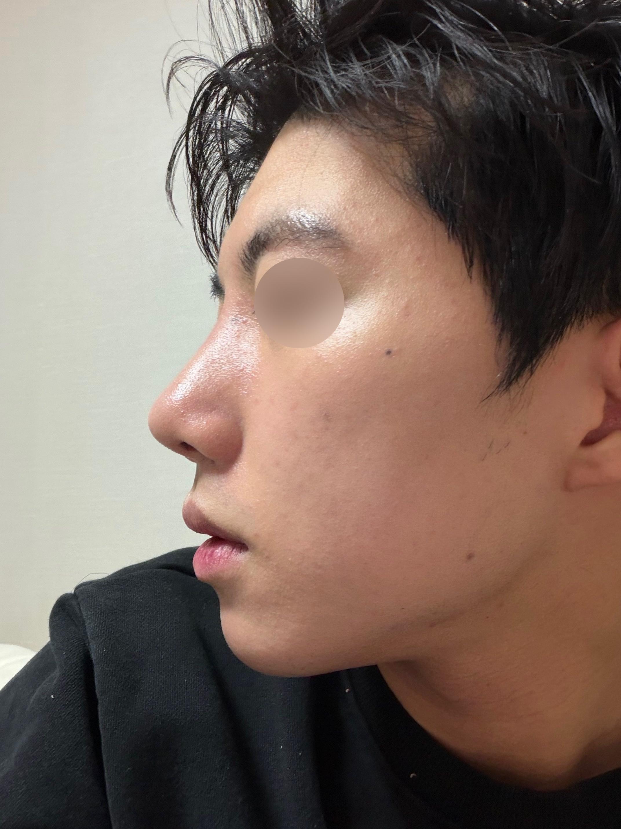 後