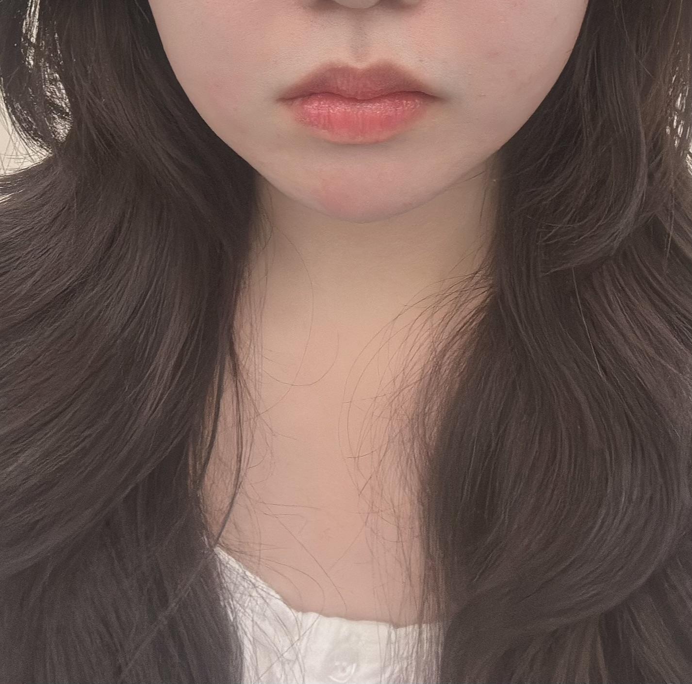 後
