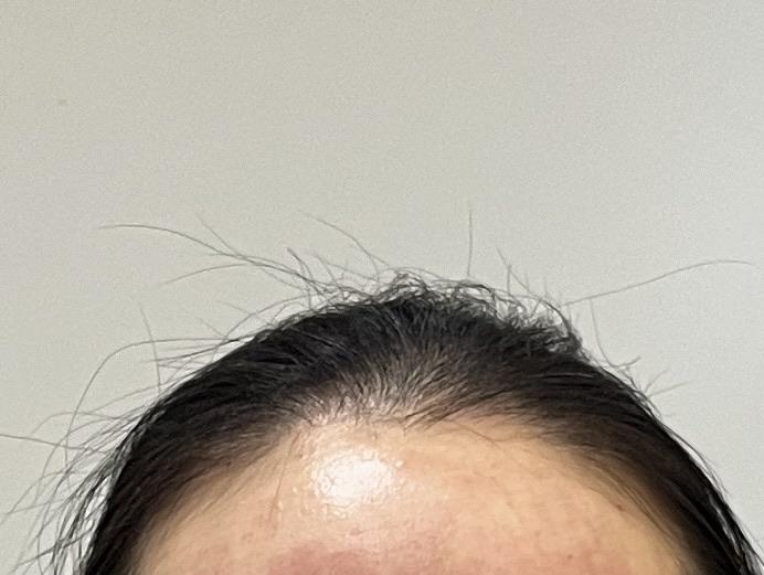 後