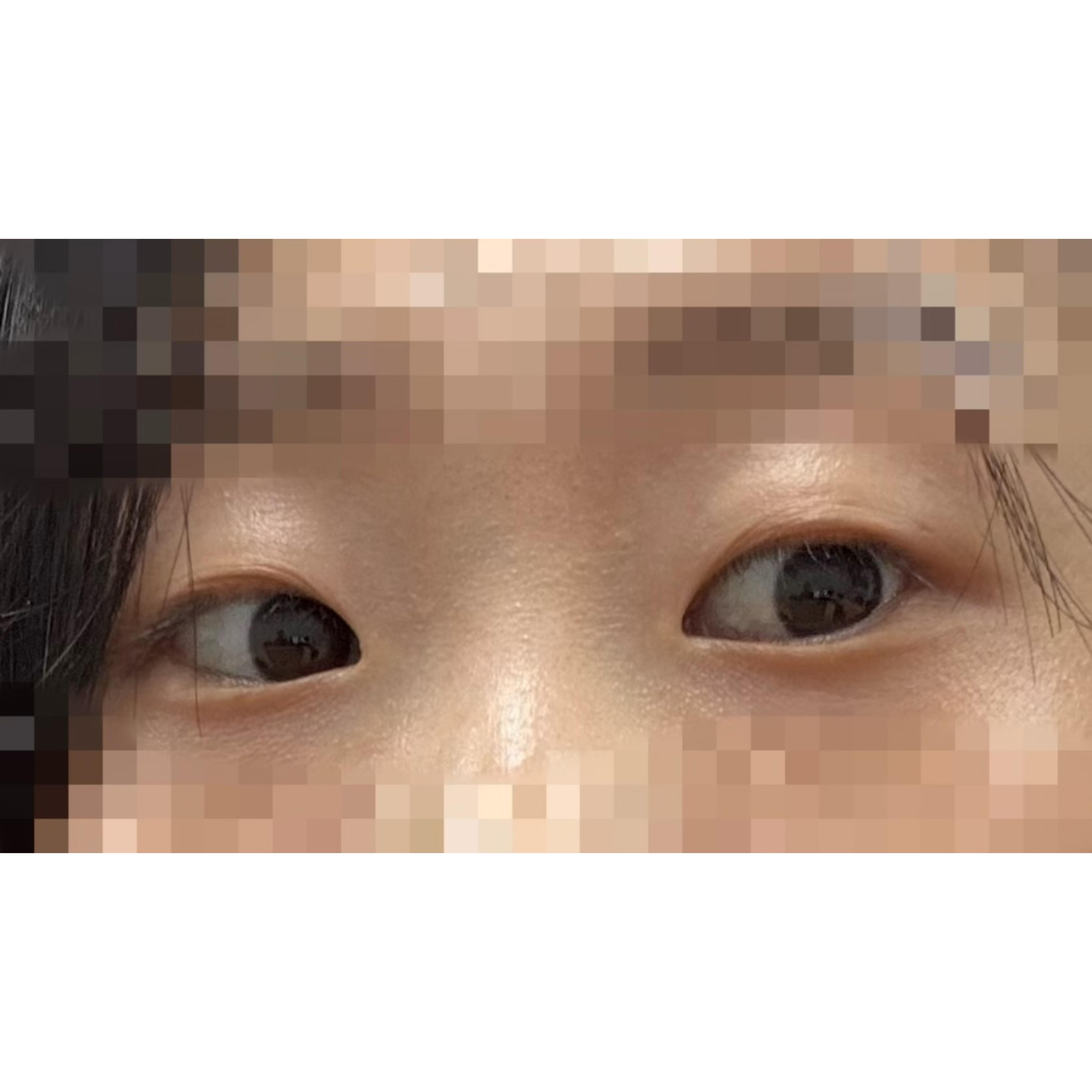 後