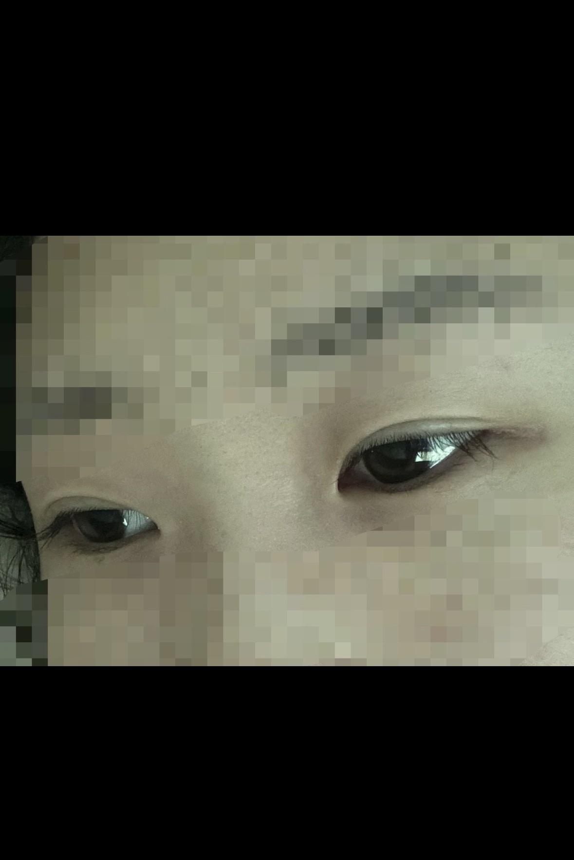 後