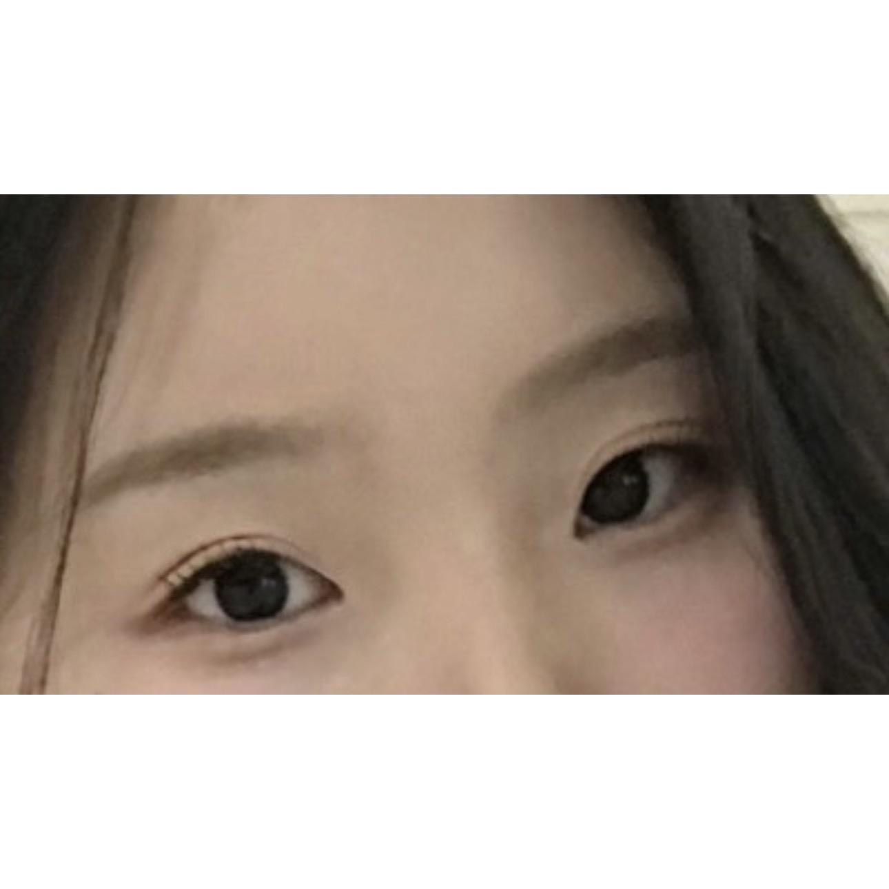後