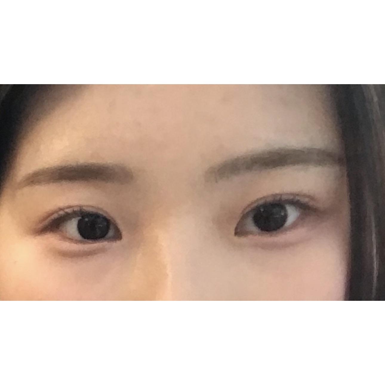 後