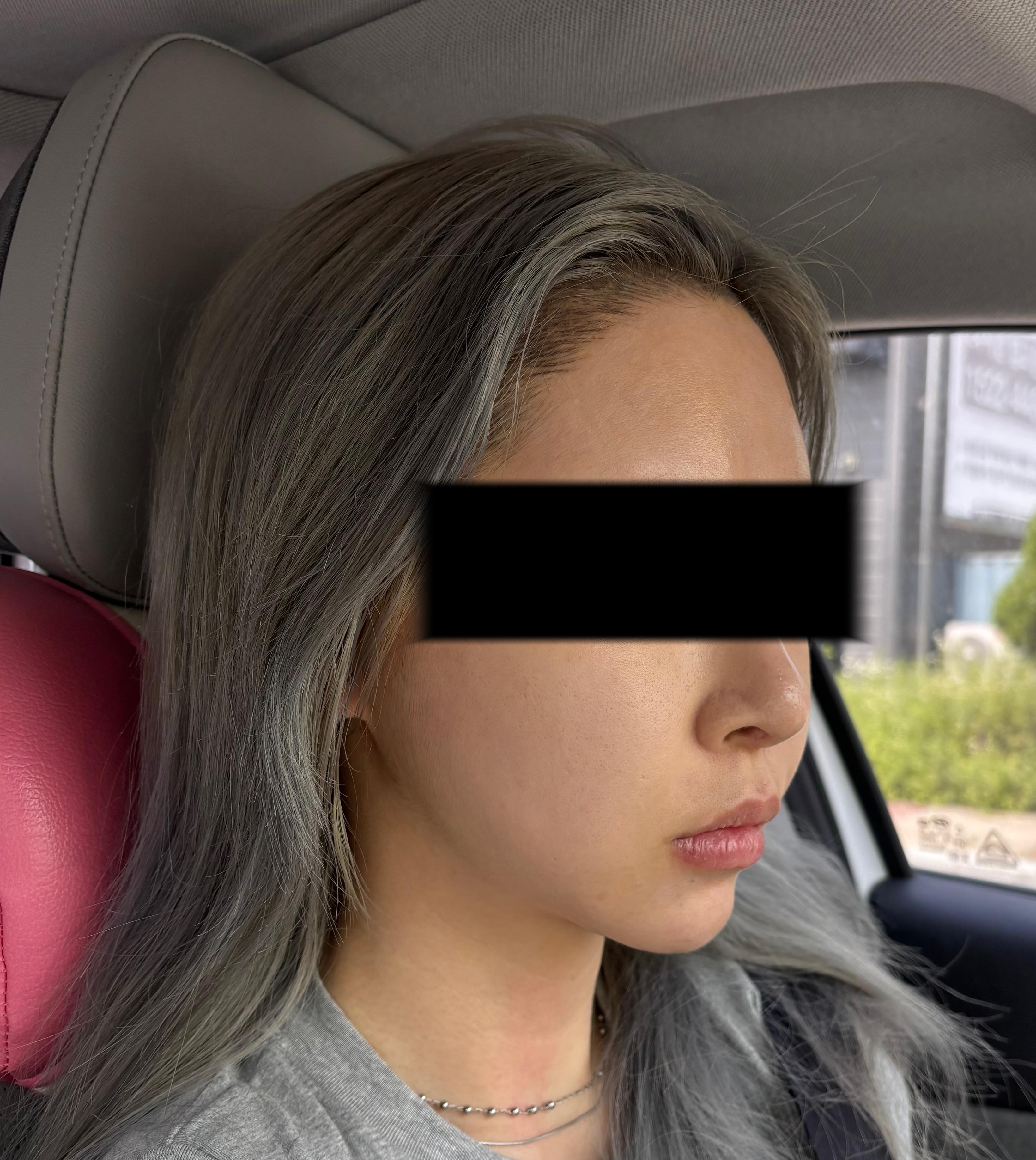 After