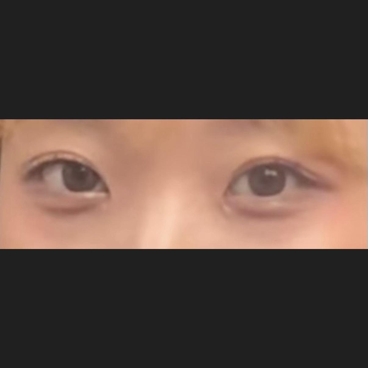 後