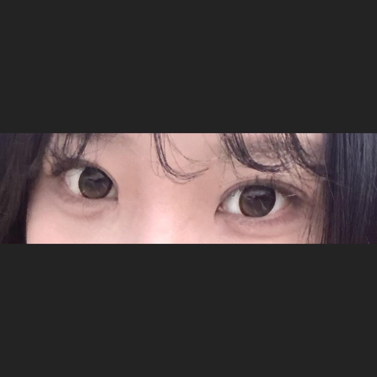 後