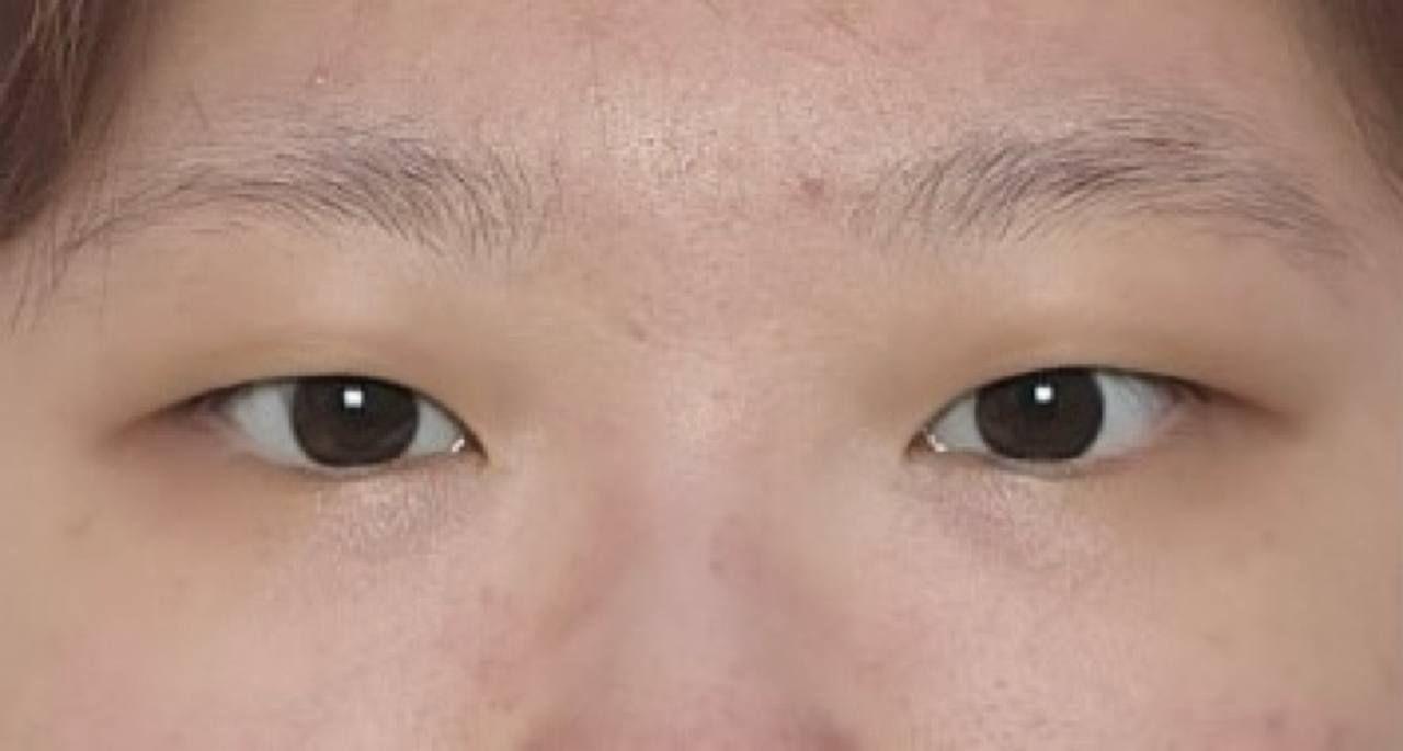 後