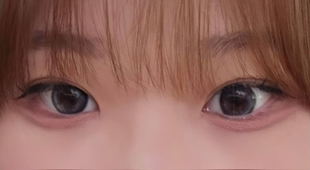 後