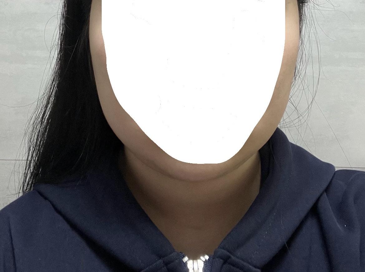 後