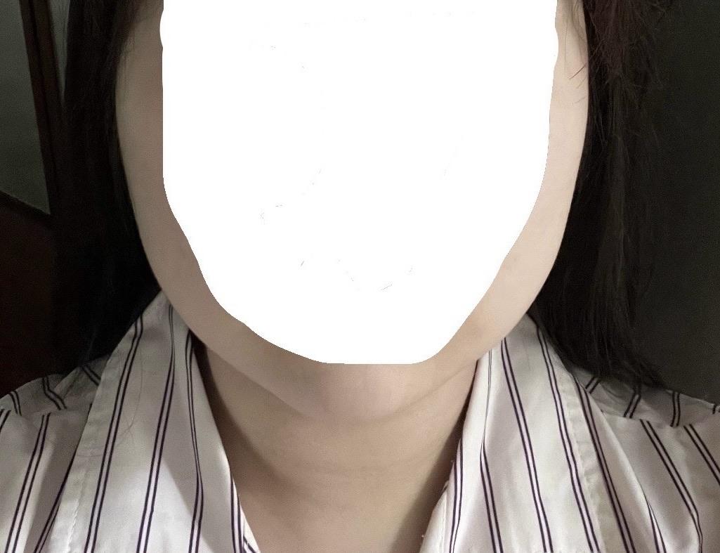 後