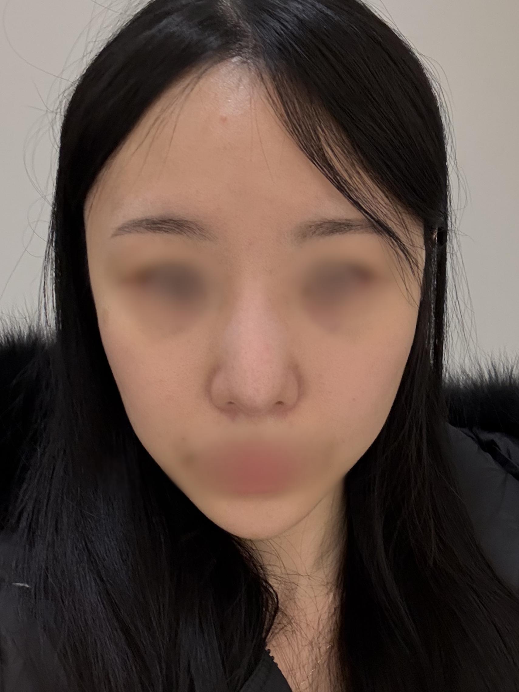 後