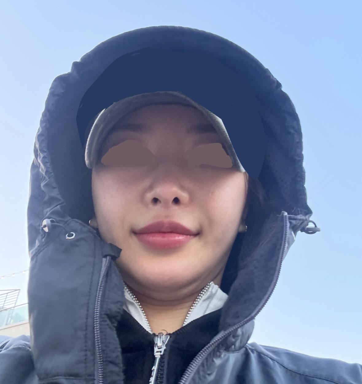 後