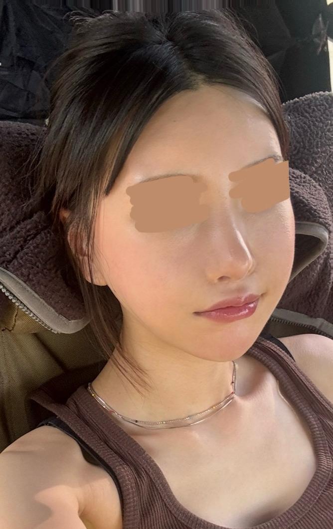 後