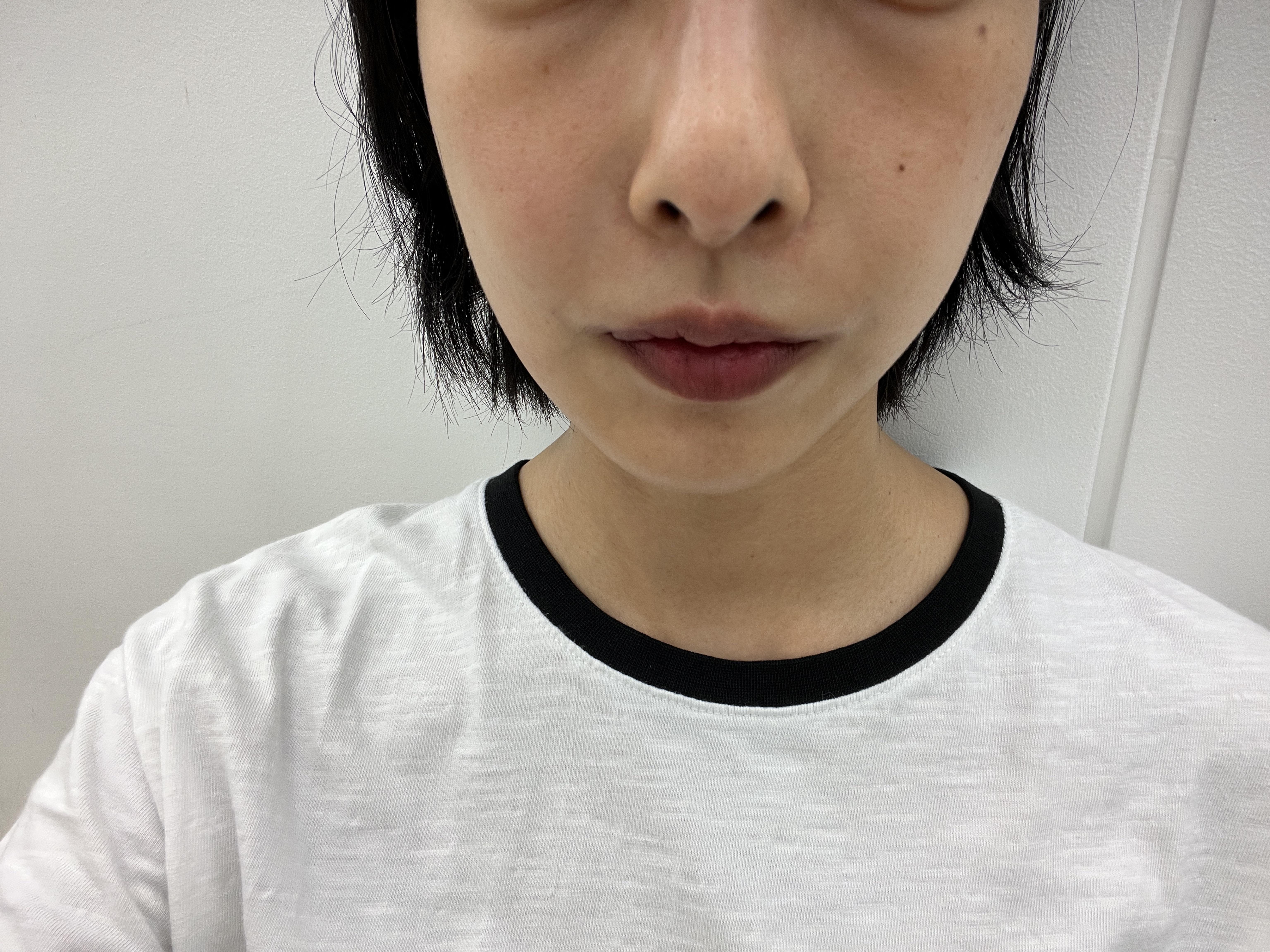 後
