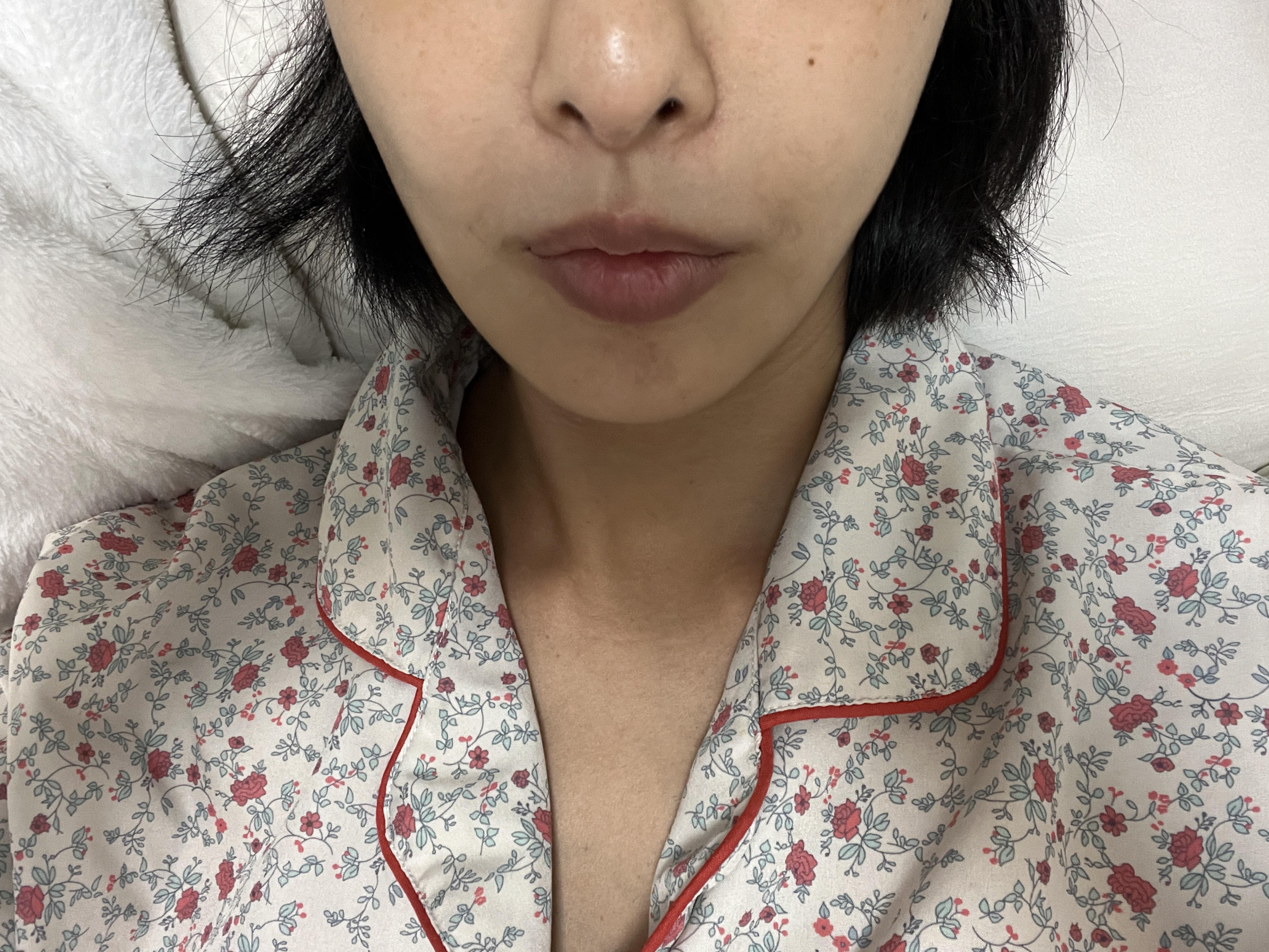 後