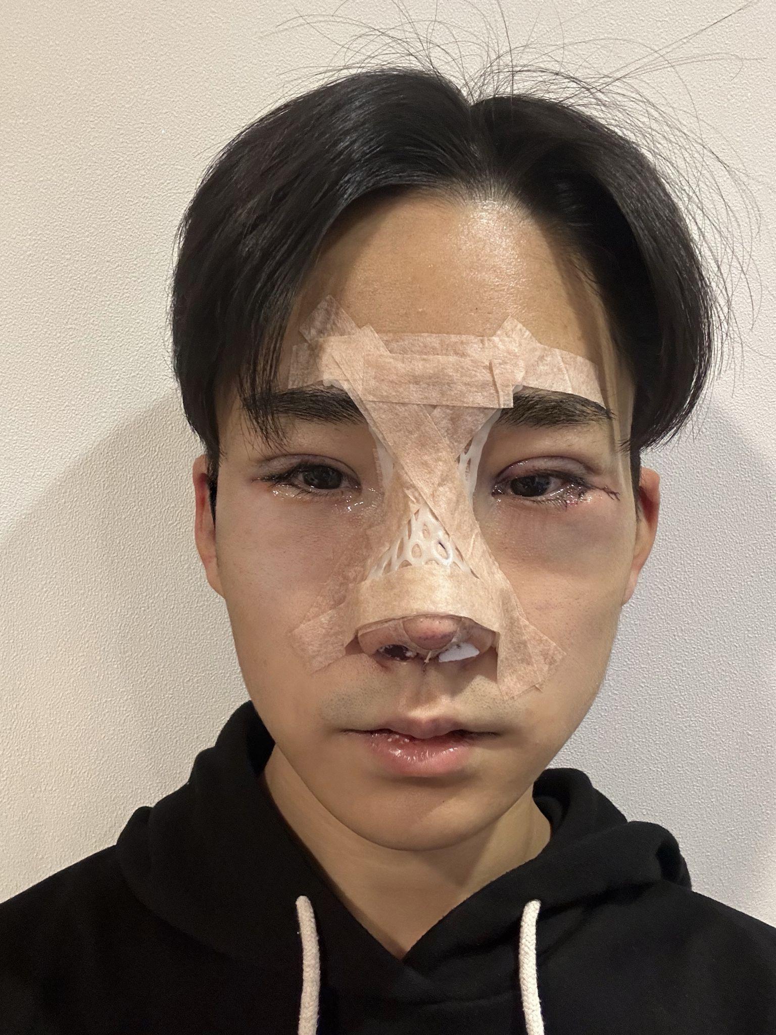 後
