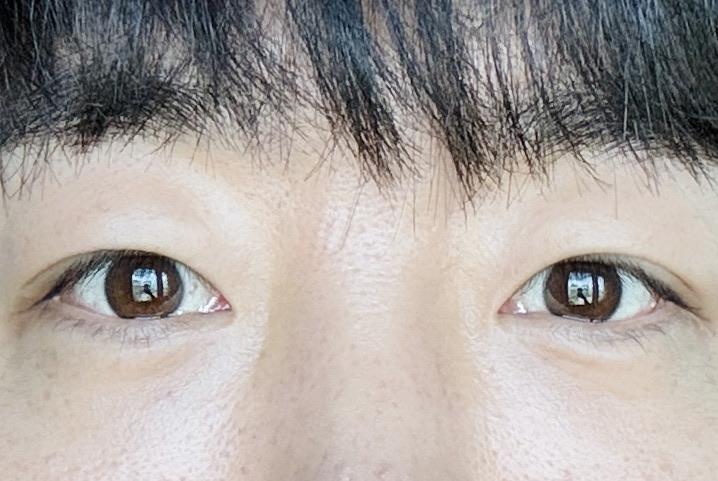 後