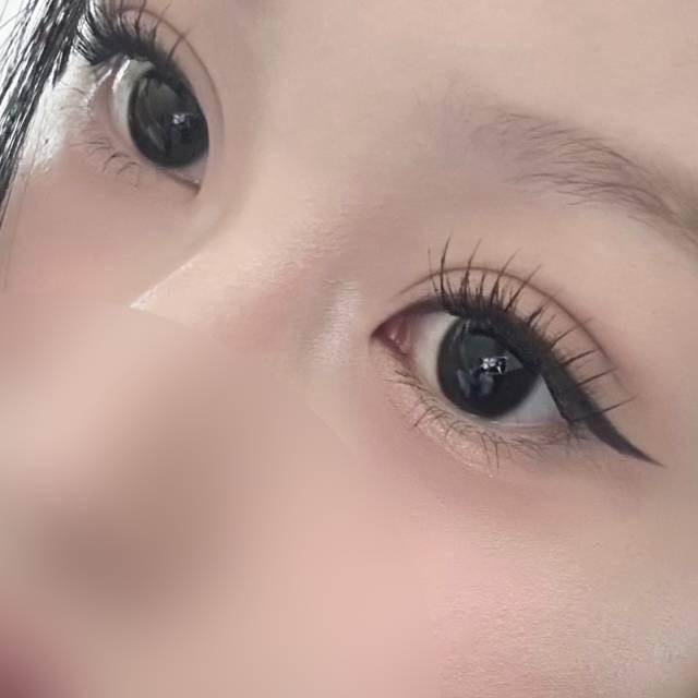 後