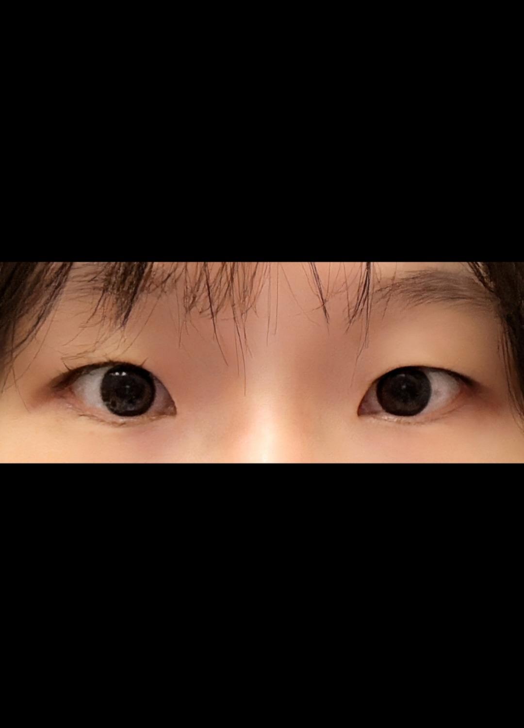 後