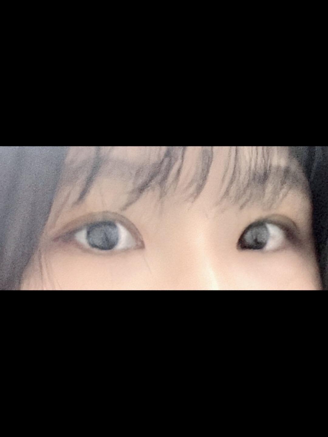 後