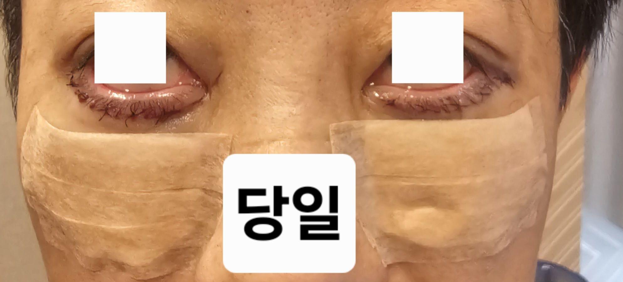 後