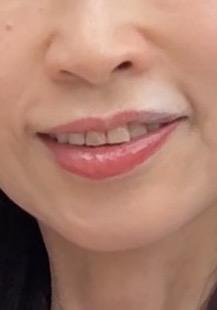 後