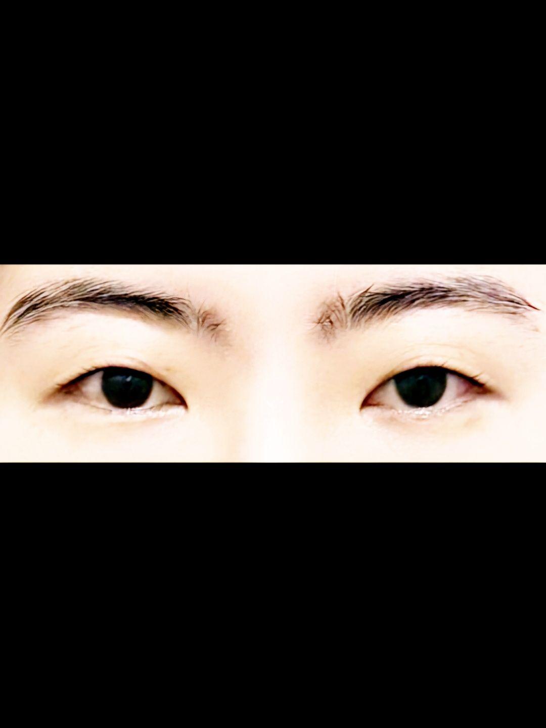 後