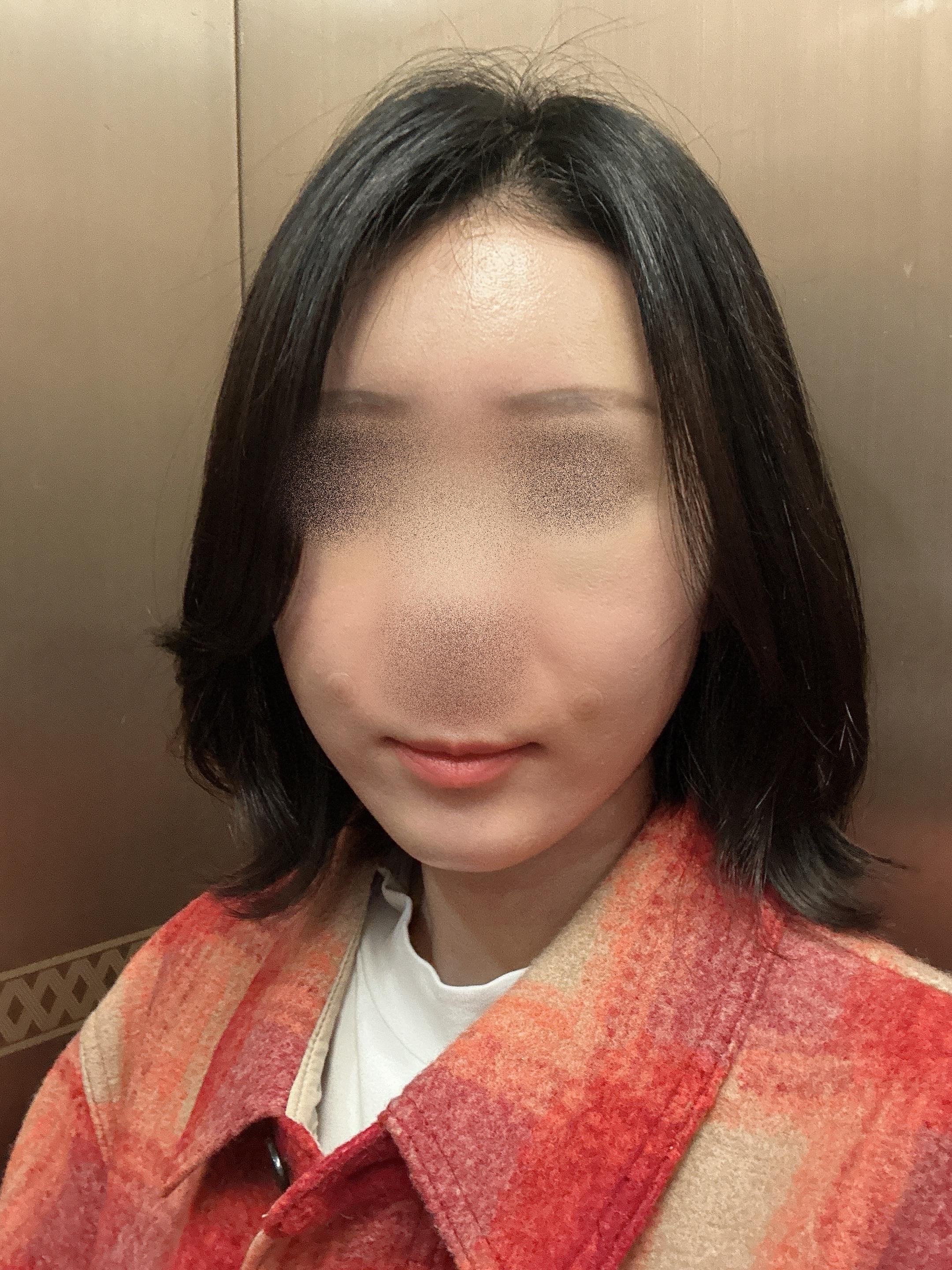 後