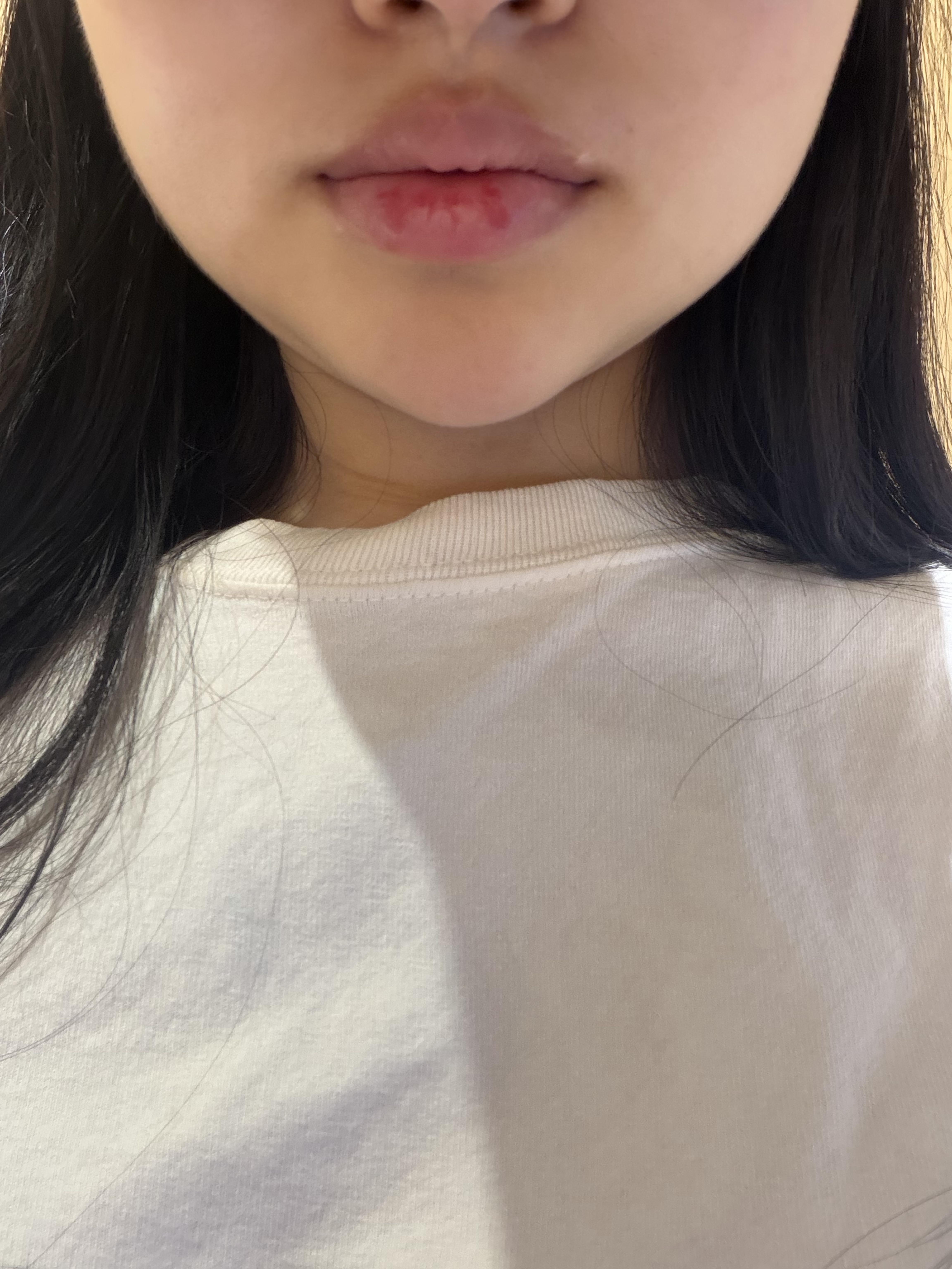 後