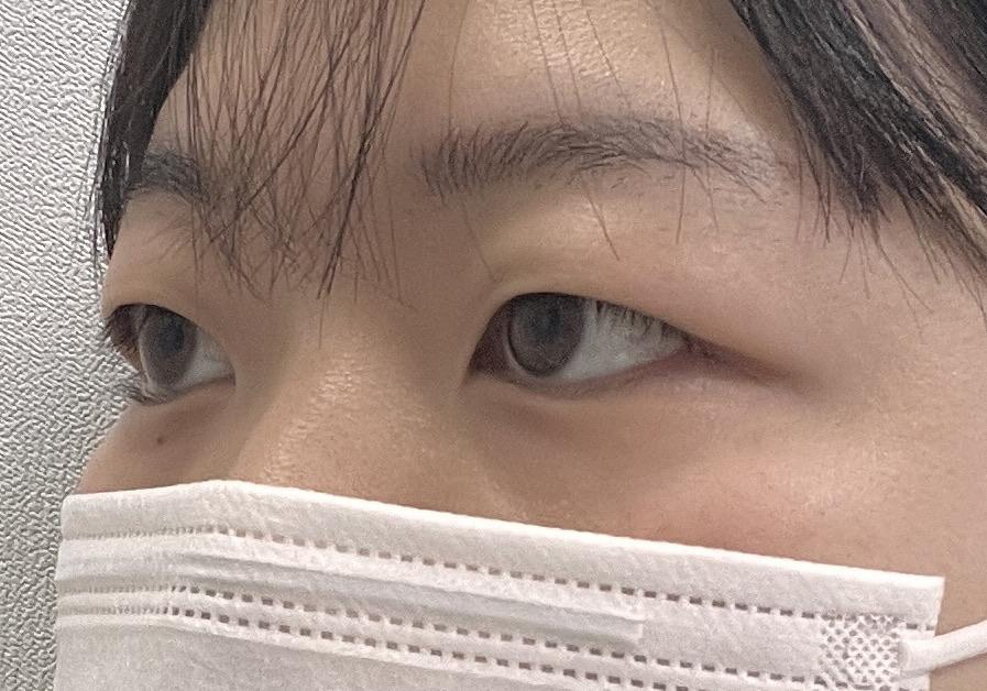 前