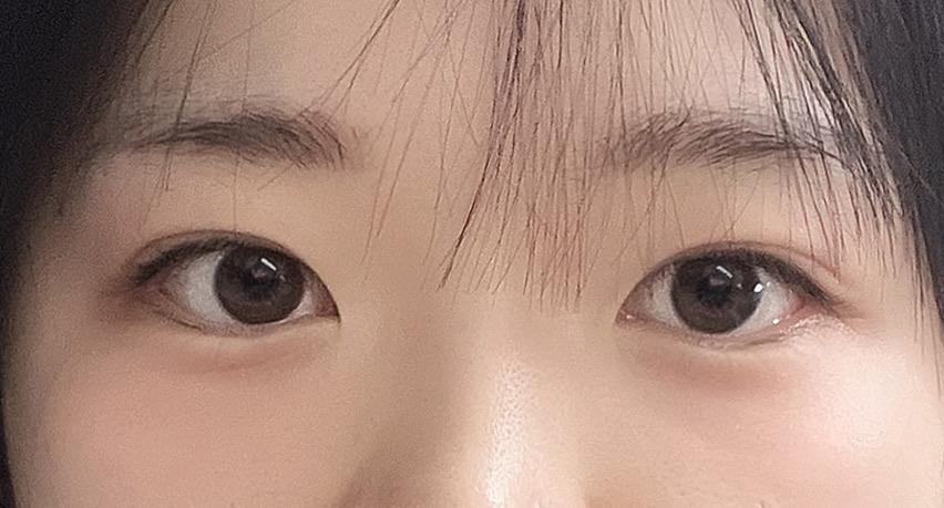 後