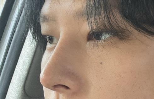 後