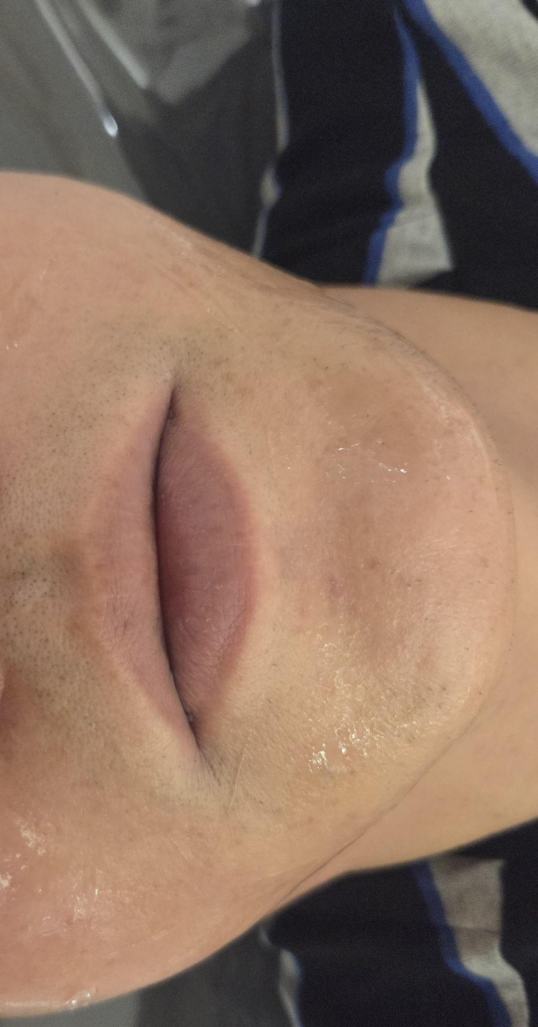 後
