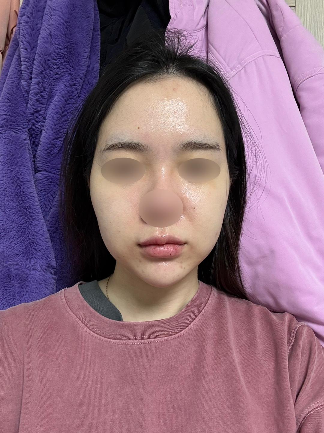 後