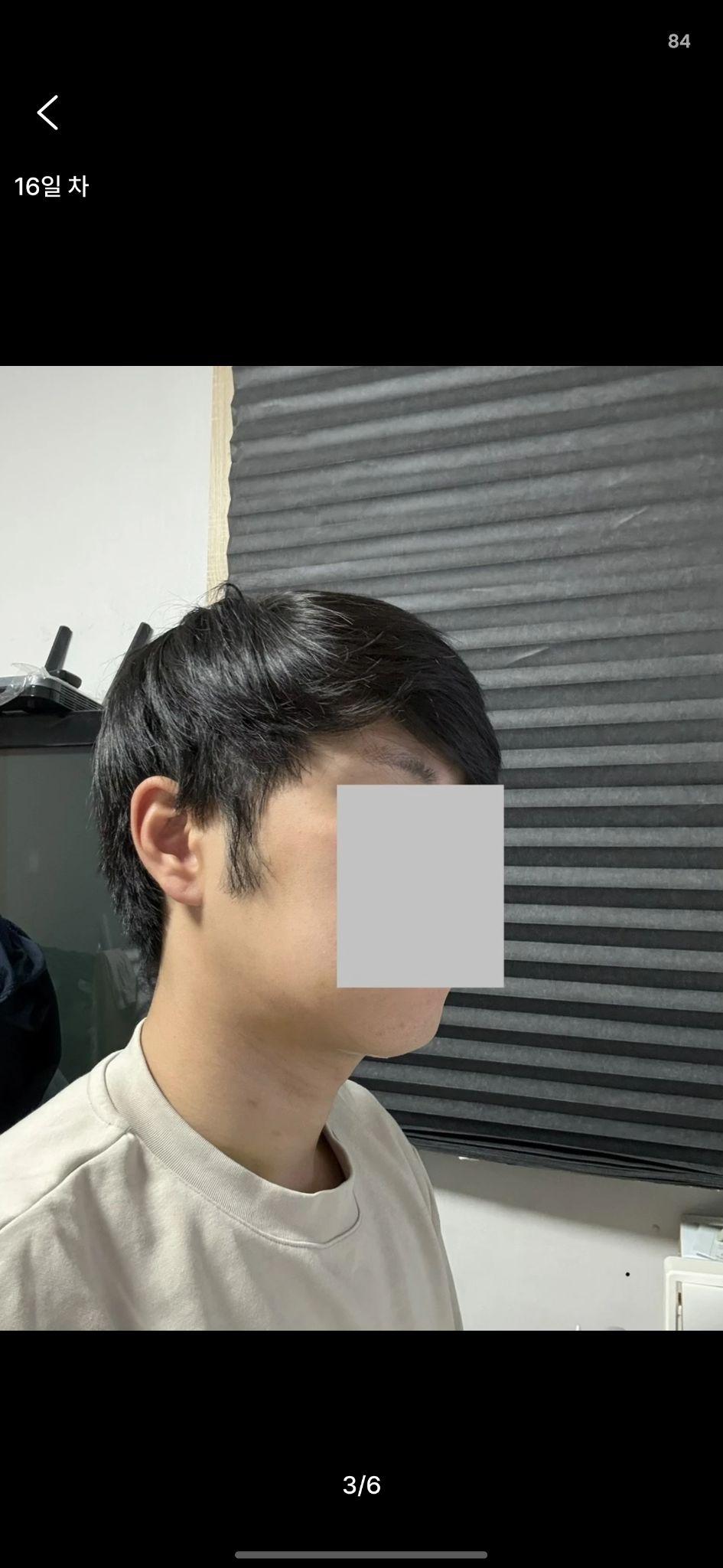 後