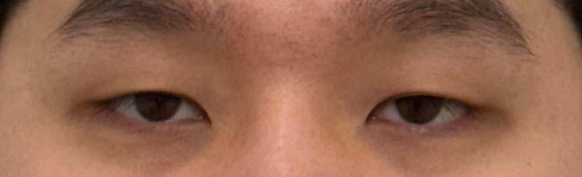 後