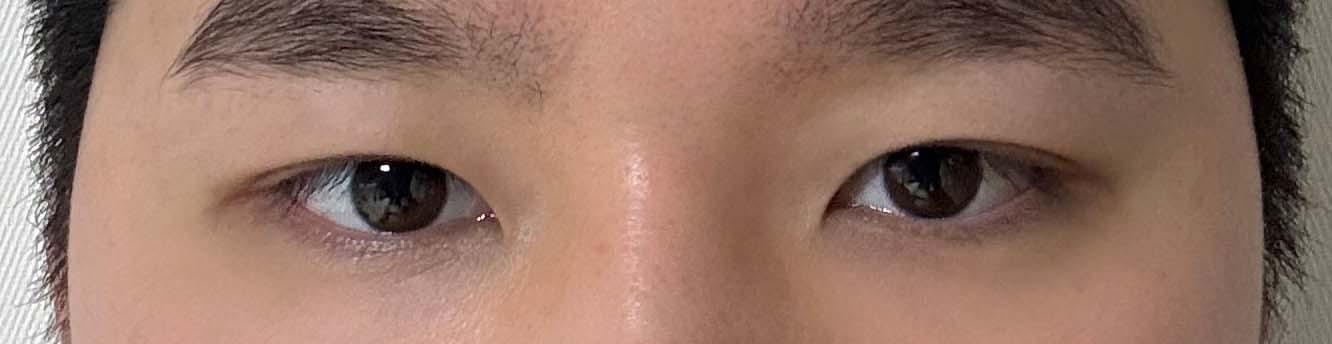後