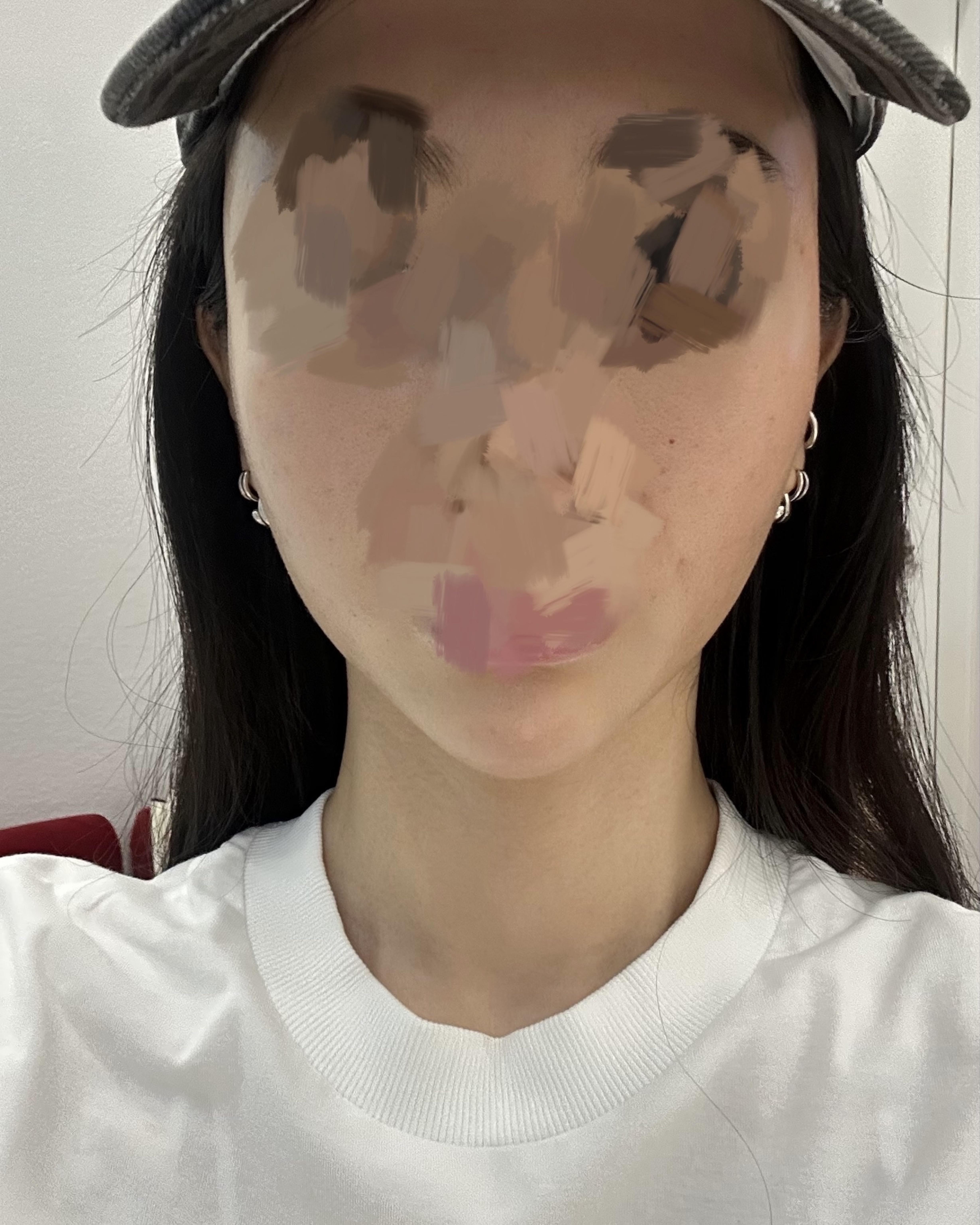後