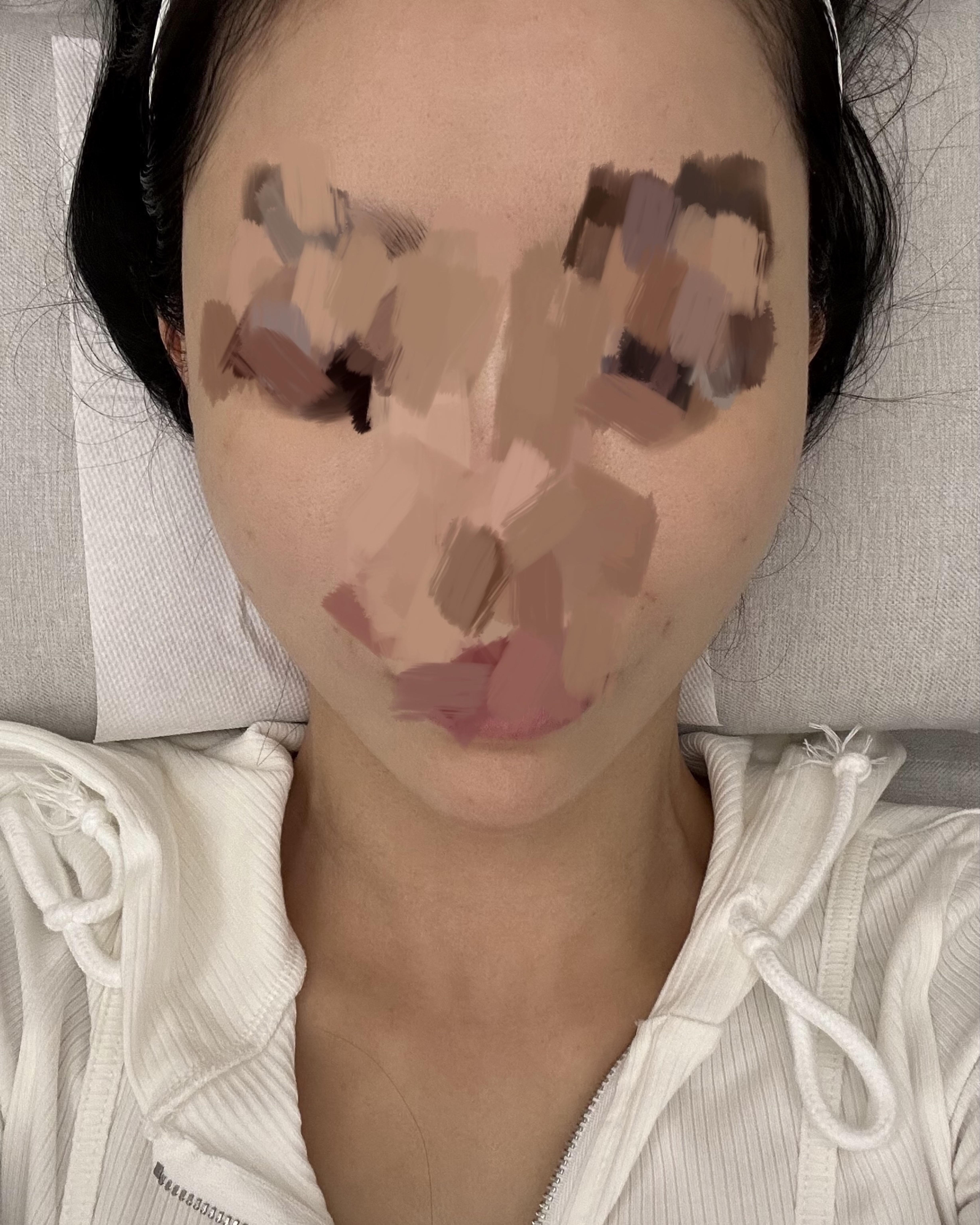 後