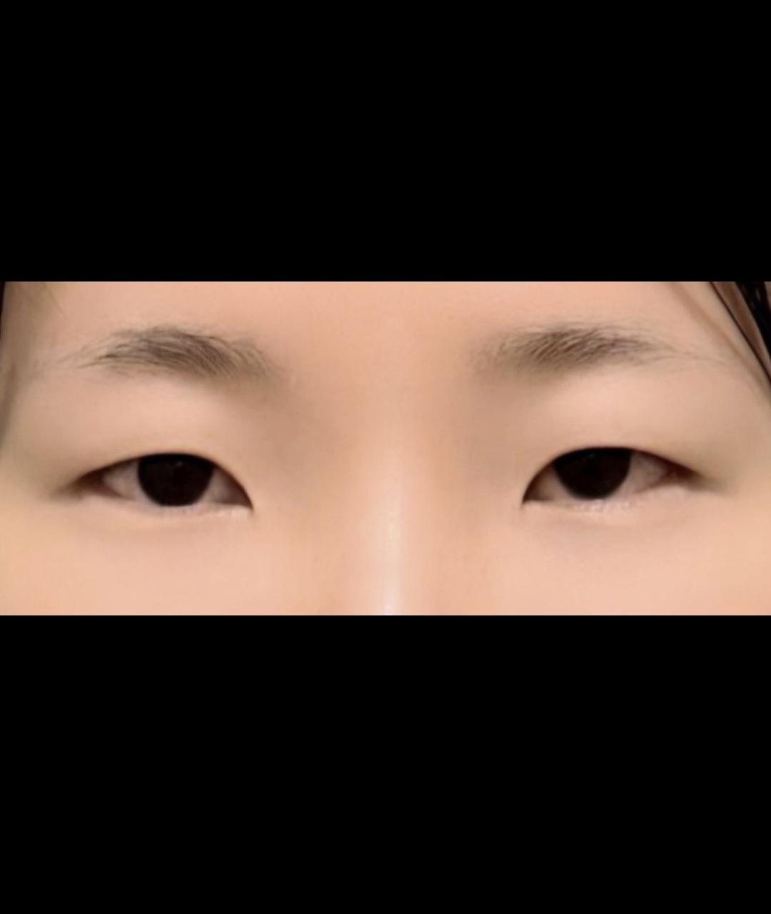 後
