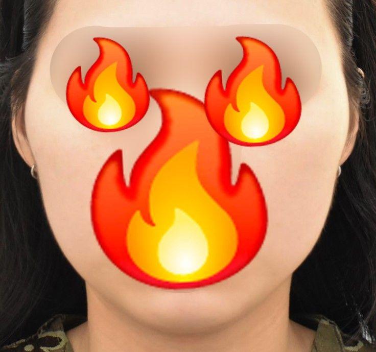 後