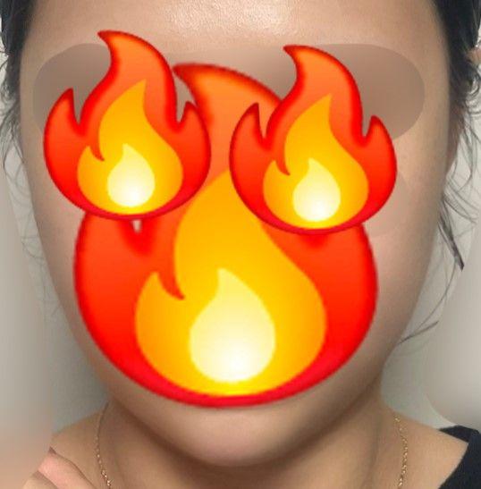 後
