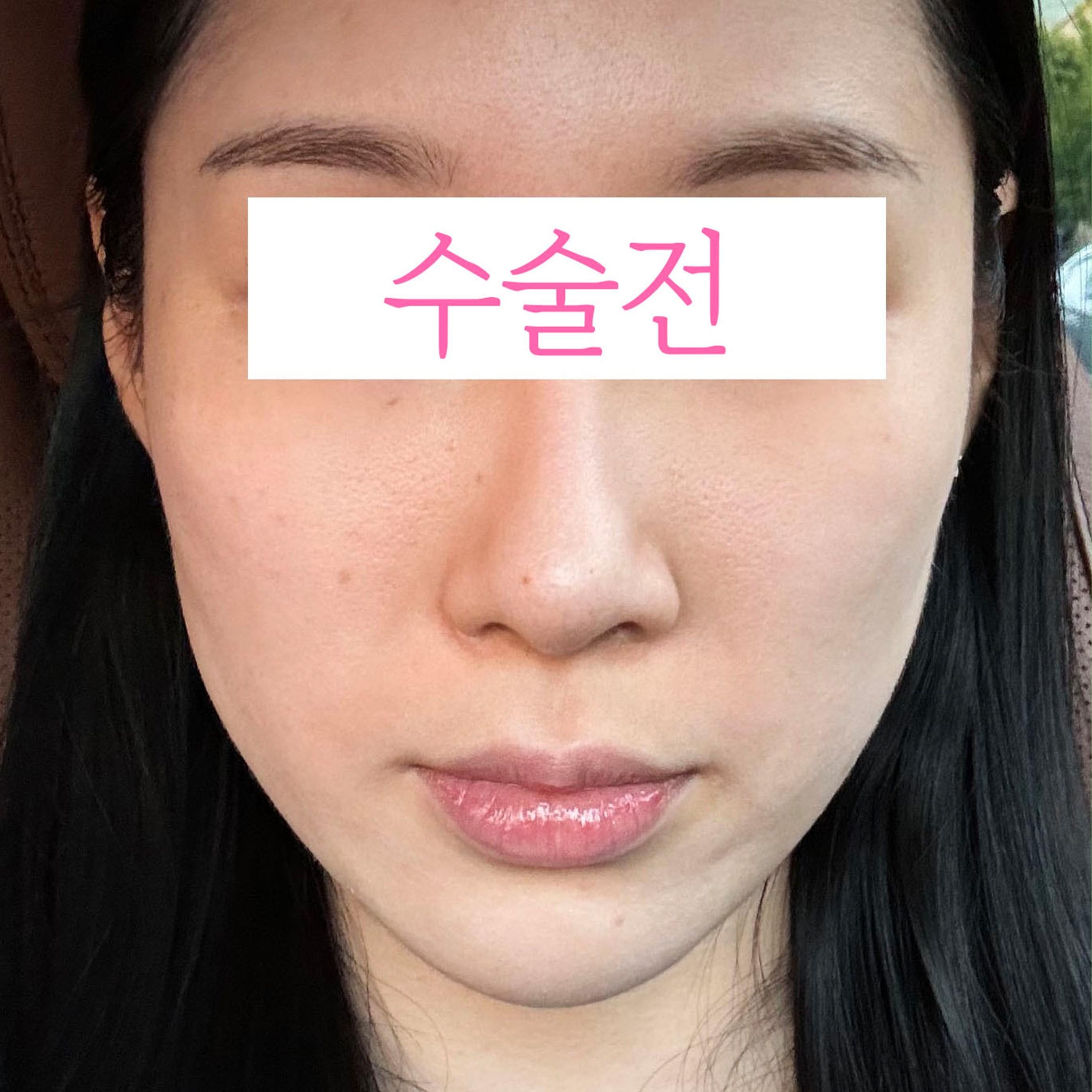 後