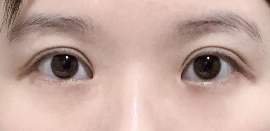 前
